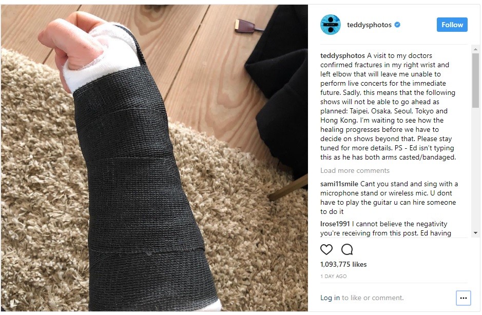 ed-sheeran-accident-zooradio.jpg
